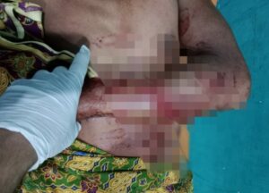 Saat Mandi di Kali Laworo, Seorang Warga Muna Barat Diterkam Buaya